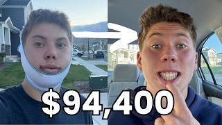 How Much Double Jaw Surgery Costs  My Complete Breakdown [upl. by Rehpotsihc]