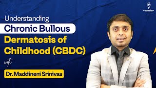 Understanding CBDC Chronic Bullous Dermatosis of Childhood with Dr Maddineni Srinivas [upl. by Eizeerb419]