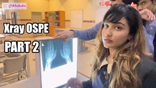 Radiology Xray OSPE Upper limb Thorax Lower Limb Anatomy Spotting PART 2 [upl. by Eendyc95]