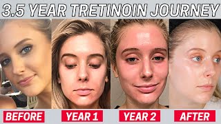 I Used Tretinoin for 35 Years and THIS happened  Tretinoin Update amp My Agency Results amp Rx [upl. by Murielle]