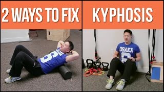 2 ways to help fix stubborn kyphosis hunchback posture [upl. by Noyad618]