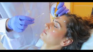 Botulinum toxin type A  Ozge Ergun MD  Plastic Surgery  Istanbul [upl. by Tnayrb]