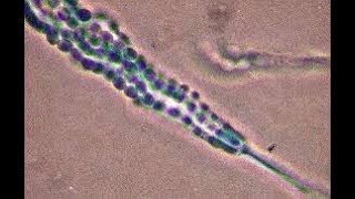 Penicillium cheresanum showing single celled conidia [upl. by Lanuk]