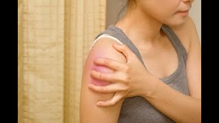 Settling a Workers Compensation Shoulder Injury [upl. by Mllly]