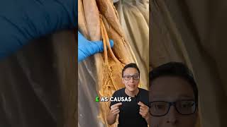 Nervo Ciático 😮🦵 curiosidades enfermagem medicina medico saude enfermeira anatomia ciatico [upl. by Pathe147]