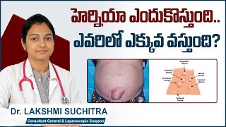 హెర్నియా ఎందుకొస్తుంది  Hernia amp Types of Hernia  Causes of Hernia in Telugu  Sankhya Hospitals [upl. by Aehsan319]