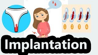 Implantation bleeding signs symptoms and what it means [upl. by Chin]