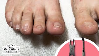 How to Clean Toenails at Home nails toenailcleaning [upl. by Mukerji]