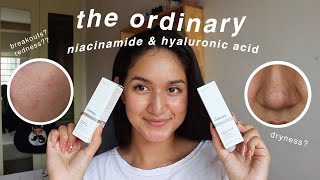 the ordinary niacinamide and hyaluronic acid 1 MONTH review with BEFOREAFTER [upl. by Anoyk733]