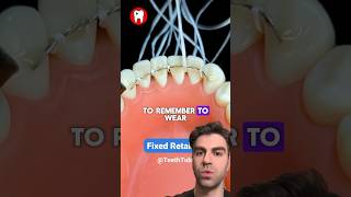 Why You Need a Fixed Retainer Dental Health 101 [upl. by Murray]