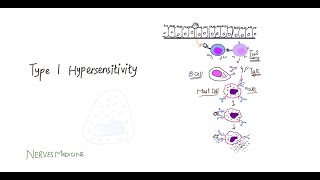 Type 1 hypersensitivity  Introduction and Pathophysiology  immediate allergic reaction [upl. by Raamaj]