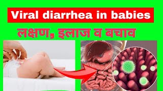 बच्चो में वायरल डायरिया के लक्षण व इलाज  how to stop diarrhea  viral gastroenteritis  diarrhea [upl. by Alleber]