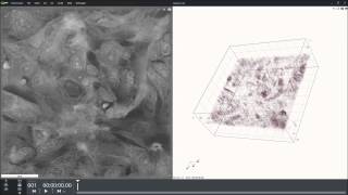 Slice of xenograft of human breast cancer in mouse Cell line MDAmb2312 [upl. by Rosanna993]