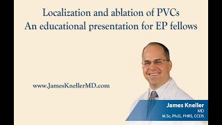 Localization and ablation of PVCsAn educational presentation for EP fellows [upl. by Llerehc]