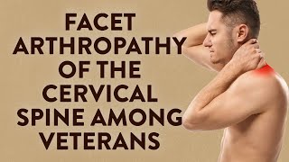 Facet arthropathy of the cervical spine among Veterans [upl. by Enrobso421]