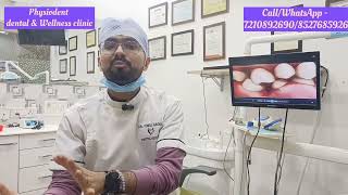 Why to replace your tooth after its removalDrVimal AroraDentist in Najafgarh Delhi [upl. by Mairem]