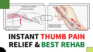 De quervain’s tenosynovitis exercises by Mr Physio wrist thumb pain relief [upl. by Shirley]