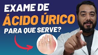 Exame de ácido úrico no sangue uricemia o que é e para que serve  Prof Dr Victor Proença [upl. by Mauretta]