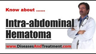 Intraabdominal Hematoma  Causes Symptoms Diagnosis Treatment Prevention [upl. by Ettenyar294]