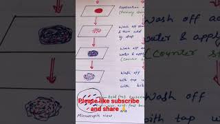 ZiehlNeelsen staining  Acid Fast staining procedure process viral youtubeshorts science short [upl. by Peyton]