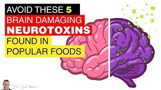 🧠 Avoid These 5 Brain Damaging Neurotoxins Found In Popular Foods  by Dr Sam Robbins [upl. by Gunzburg827]