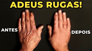 Receita AntiRugas ESTICA PELE Das MÃOS e ROSTO😱 [upl. by Babbie543]