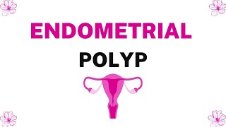 Endometrial Polyp  DefinitionCFPathophysiologyInvestigationsTreatment  Gynaecology [upl. by Arvin]