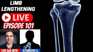 Limb Lengthening LIVE Episode 101  Alternative Limb Lengthening Methods [upl. by Egduj505]