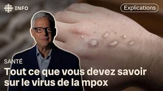 Virus mpox  câ€™est quoi et comment se transmetil [upl. by Anabal]