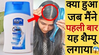 Scalpe Pro Shampoo Review  Scalpe Shampoo  Scalpe Pro Anti Dandruff Shampoo Review [upl. by Cyril]