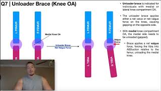 Ossur Unloader One Knee Brace at DMEDirectcom [upl. by Roydd]