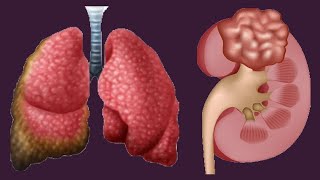 Low And High Hematocrit Levels Causes And Symptoms [upl. by Egiap]