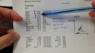 Hematology How to interpret automated Complete Blood Count CBC results [upl. by Esiouqrut239]