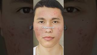 Zuniga on Natural Face Mask Glow Up in 7 Days [upl. by Essyle]