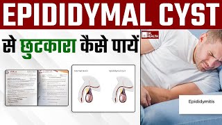 Epididymal सिस्ट cyst से छुटकारा कैसे पायें  Get rid of Epididymal cyst naturally  DrHealth [upl. by Alodi]