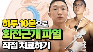 회전근개파열 이렇게 치료합니다 feat내 어깨 내가 치료해 [upl. by Sordnaxela]