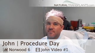 Hair Transplant Miami  Hair Surgery Miami John [upl. by Nashoma]