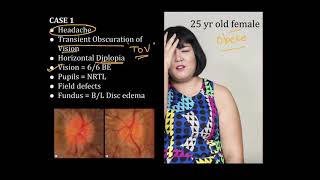 High Yield Topic  Papilledema  A Complete Review [upl. by Kiyoshi999]