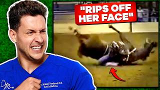 Doctor Reacts To Shocking Horse Riding Injuries [upl. by Ellehcem]