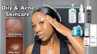 SKINCARE ROUTINE FOR OILY ACNEPRONE SKIN  A routine for smooth amp clear Skin ‼️ [upl. by Ekard]