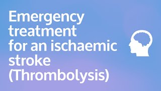 Emergency treatment for an ischaemic stroke Thrombolysis [upl. by Eed632]