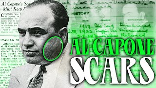 The Untold Story of Al Capones Scars A Deep Dive into His Past [upl. by Annuahsal70]