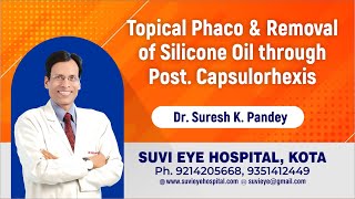 Topical Phaco amp Removal of Silicone Oil through Post Capsulorhexis Dr Suresh Pandey [upl. by Iand337]