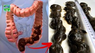 How To Clean Your Stomach and Intestines Naturally in One Day [upl. by Fabrienne]