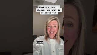 What are tonsil stones and how do you get rid of them shorts [upl. by Asirac]