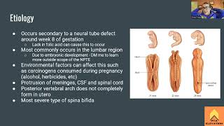 Spina Bifida Myelomeningocele  NPTE Prep [upl. by Aveer130]