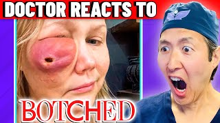 Plastic Surgeon Reacts to BOTCHED Facial Fillers Did THIS [upl. by Monjan]