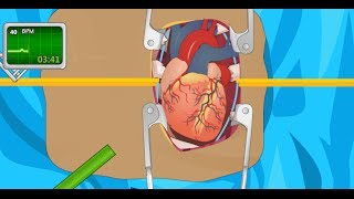 Operate Now Heart Surgery Fast Walkthrough [upl. by Anahpos]