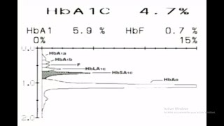 les techniques de dosage Technique HPLC pour dosage HBA1c [upl. by Ennybor]