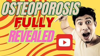 Surprising Facts About Osteoporosis Revealed [upl. by Name524]